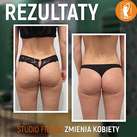 Studio Figura Białystok Grabówka