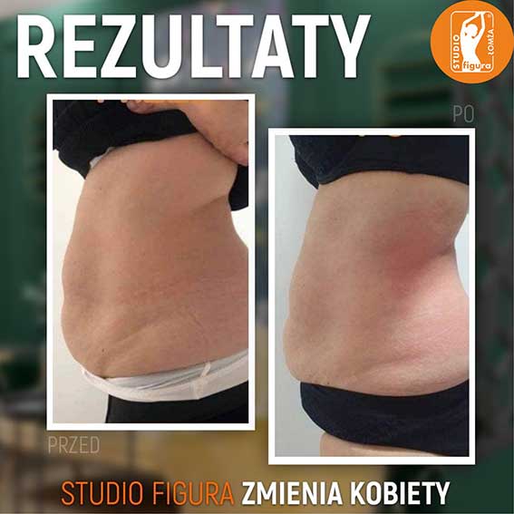 Studio Figura Białystok Grabówka