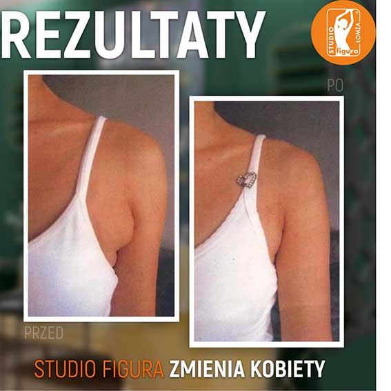 Studio Figura Białystok Grabówka