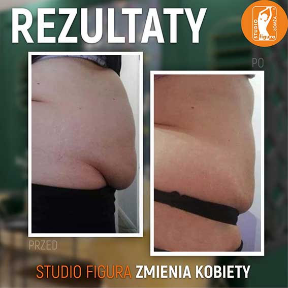 Studio Figura Białystok Grabówka