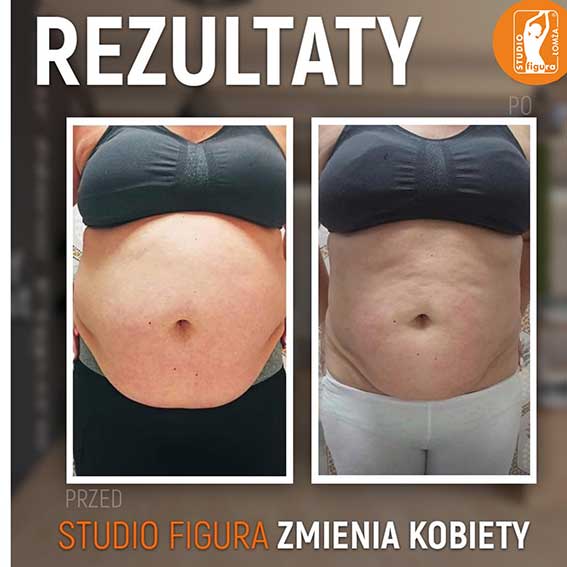 Studio Figura Białystok Grabówka