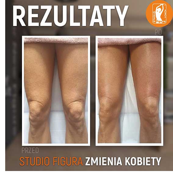 Studio Figura Białystok Grabówka