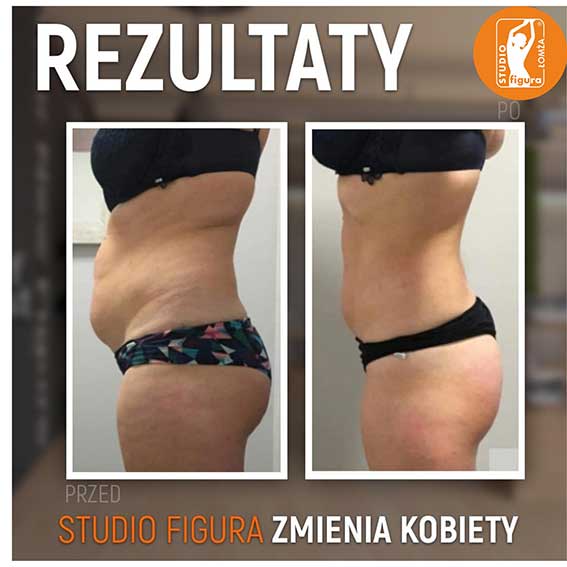 Studio Figura Białystok Grabówka