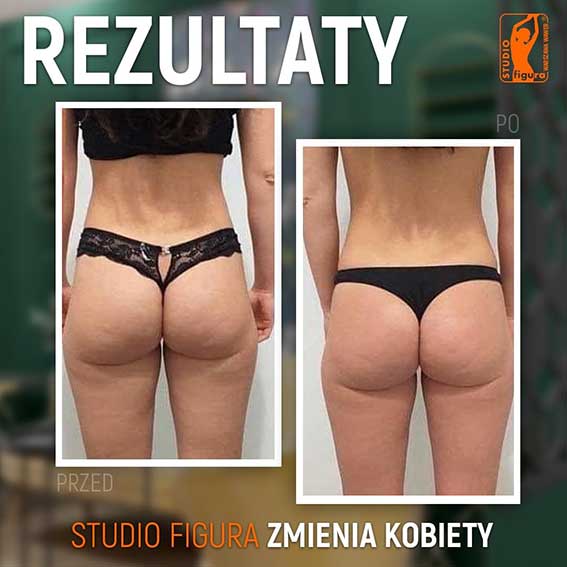 Studio Figura Białystok Grabówka