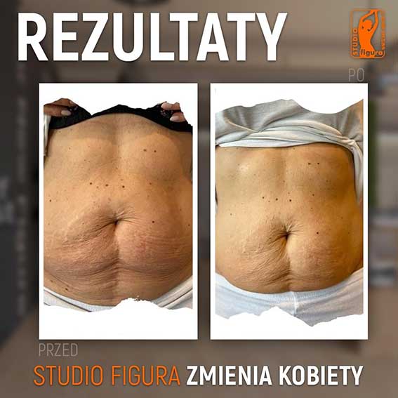 Studio Figura Białystok Grabówka