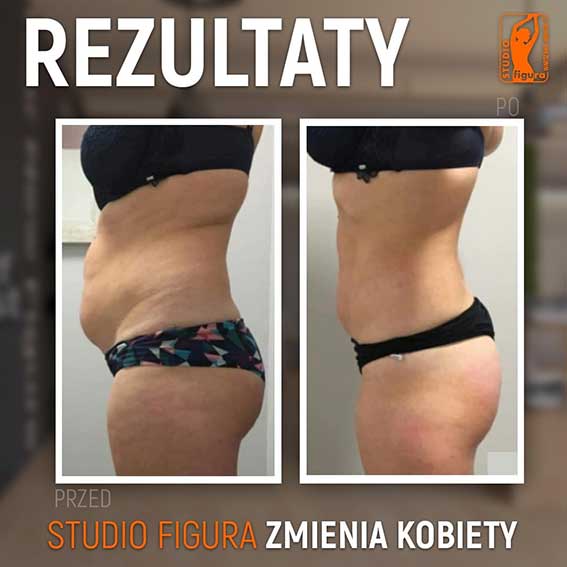 Studio Figura Białystok Grabówka